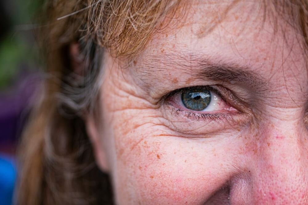 How to Handle Dry Eyes Menopause Struggles