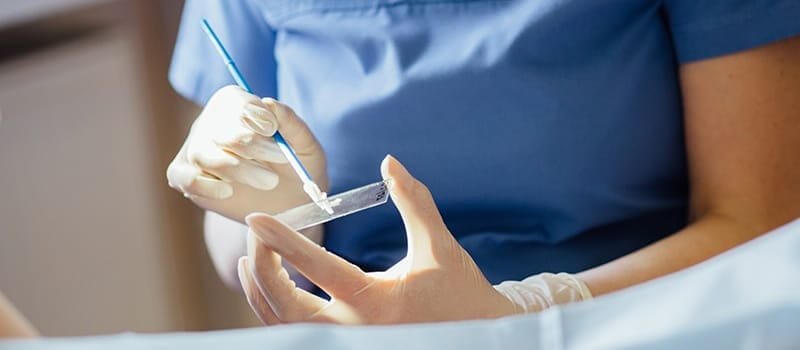 Pap Smear: Don’t Let Your Period Stop You